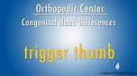 trigger thumb - congenital hand differences - Children's Hospital Boston