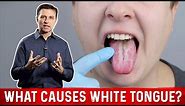 What Causes White Tongue? – Dr.Berg on Oral Candidiasis
