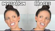 Braces or Invisalign? (Which is BETTER)