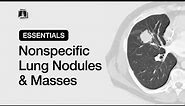 Nonspecific Lung Nodules & Masses | Chest Radiology Essentials