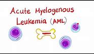 Acute Myeloid Leukemia (AML) | Auer Rods | Myeloperoxidase Positive - Hematology