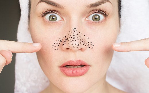 Oily Nose: Causes, Remedies & Prevention Tips