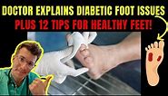 Doctor explains DIABETIC FOOT COMPLICATIONS - PLUS 12 TIPS FOR PREVENTION!