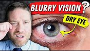 Why Dry Eyes Cause Blurry Vision - 3 Reasons, And 3 Home Remedies