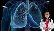 Diagnosing Lung Cancer by early identification of pulmonary nodules.