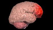 What is a Frontal Lobe Injury?
