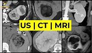 Imaging of Renal Masses [ALL YOU NEED TO KNOW] | Dr. Daniel J. Kowal (RadiologistHQ)