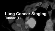 Lung Cancer Staging - Tumor (T)