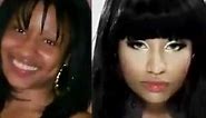 Nicki Minaj Before & After Plastic Surgery [Must Watch]