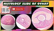 Histology practical slide of ovary