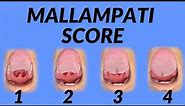 Mallampati Score (Airway Assessment Technique) Animation