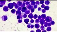 Mast cell tumour overview and cytology