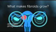 Fibroid Tumors