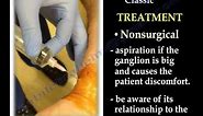 Ganglion Cyst of the wrist, volar - Everything You Need To Know - Dr. Nabil Ebraheim