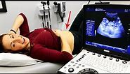 Doctor Knows the Baby's Gender! - 14 Week Pregnancy Ultrasound