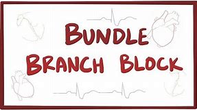 Bundle branch block - causes, symptoms, diagnosis, treatment, pathology