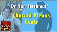 CPC: Choroid Plexus Cysts on Ultrasound in Pregnancy Discussed by Dr Nari Heshmati