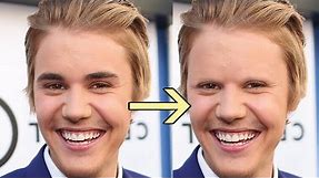 14 Celebrities Without Eyebrows