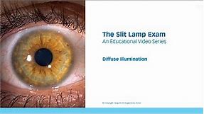 The Slit Lamp Exam – Episode 6, Diffuse Illumination