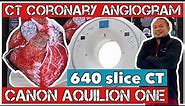 CT CORONARY ANGIOGRAM | CANON AQUILION ONE | 640 Slice CT