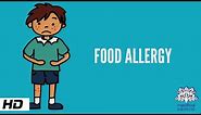 Food Allergy, Causes, Signs and Symptoms, Diagnosis and Treatment.