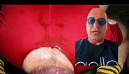 Howie Mandel casually posting a picture of a prolapsed anus on his tiktok