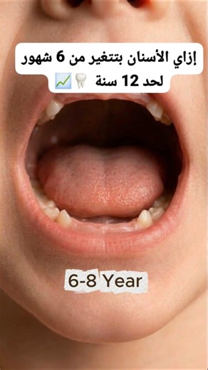 How teeth change from 6 months to 12 years old 🦷📈 #dentalcare #cosmeticdentistry #dentist #explor...