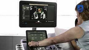How to Perform a Full Volume Acquisition on a Philips EPIQ Ultrasound