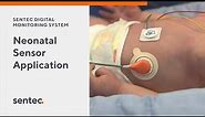 Neonatal Sensor Application for the Sentec Digital Transcutaneous Monitoring System