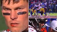 Tom Brady’s lip bloodied, gets flagged for screaming at ref during disastrous first half