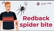 Redback Spider Bite | First Aid