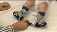 Clubfoot Stretches | Ponseti Brace | Module 4