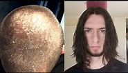 7 years no shampoo results