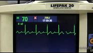 EKG Training: Watching and Interpreting the Defibrillator Monitor