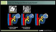 Imaging renal cystic masses