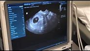 Pregnancy ultrasound at 6 weeks!!