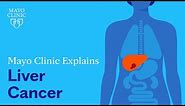 Mayo Clinic Explains Liver Cancer