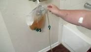 How Drain Urinary CATHETER BAG (Release Pour Empty Remove Leg Urine Foley BARD Bardia Night Drainage