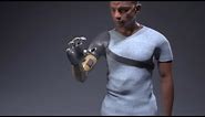 Bionic Arm That Restores Natural Movements, Sensation and Touch