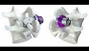 The Minuteman Procedure - Minimally Invasive Spinal Fusion