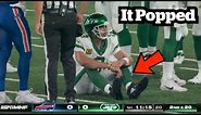 Aaron Rodgers Achilles Snaps - Doctor Explains Injury