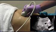How I do it: Ultrasound of the Abdomen