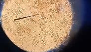 Trichomonas vaginalis under microscope