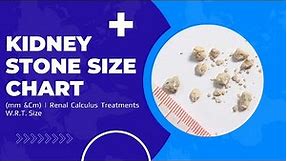 Kidney Stone Size Chart (mm &Cm) | Renal Calculus Treatments W.R.T. Size