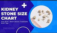 Kidney Stone Size Chart (mm &Cm) | Renal Calculus Treatments W.R.T. Size