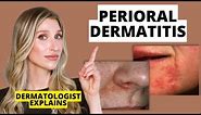 Dermatologist Explains Perioral Dermatitis (What it Looks Like, Causes, & Treatments) | Dr Sam Ellis