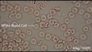 Red blood cells under the microscope, hypo and hypertonic solutions
