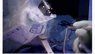 Robot-Assisted Spine Surgery at UCSF
