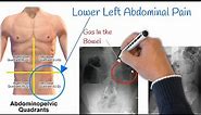 Pain in lower left abdomen - Low Stomach Pain, Most Common Causes