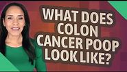 What does colon cancer poop look like?